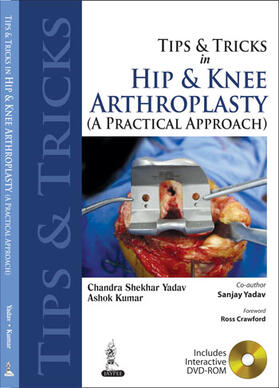 Yadav / Kumar |  Tips and Tricks in Hip and Knee Arthroplasty | Buch |  Sack Fachmedien