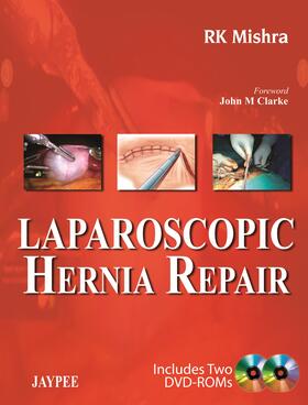 Mishra |  Laparoscopic Hernia Repair | Buch |  Sack Fachmedien