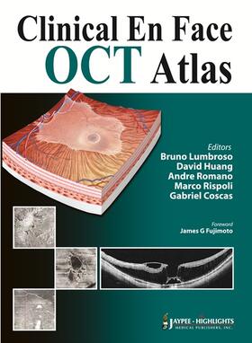 Lumbroso / Huang / Romano |  Clinical En Face OCT Atlas | Buch |  Sack Fachmedien