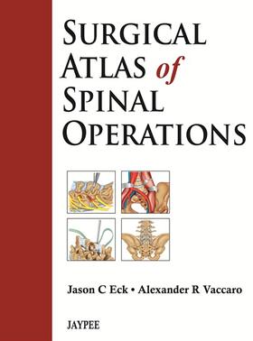 Eck / Vaccaro |  Surgical Atlas of Spinal Operations | Buch |  Sack Fachmedien