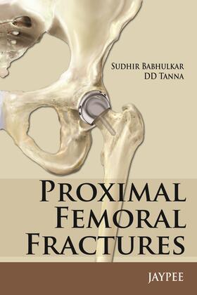 Babhulkar / Tanna |  Proximal Femoral Fractures | Buch |  Sack Fachmedien