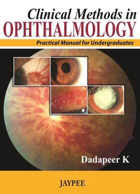 K |  Clinical Methods in Ophthalmology: Practical Manual for Undergraduates | Buch |  Sack Fachmedien