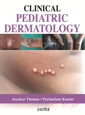 Thomas / Kumar |  Clinical Pediatric Dermatology | Buch |  Sack Fachmedien