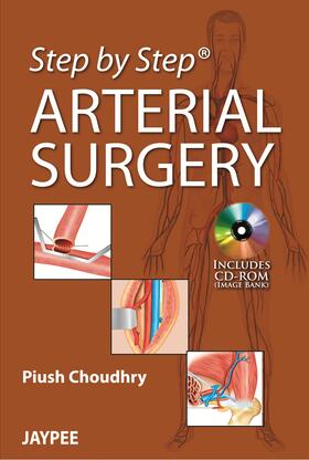 Choudhry |  Choudhry, P: Step by Step: Arterial Surgery | Buch |  Sack Fachmedien