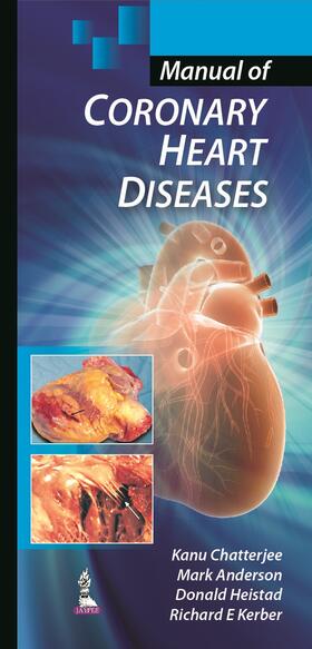 Chatterjee / Anderson / Heistad |  Chatterjee, K: Manual of Coronary Heart Diseases | Buch |  Sack Fachmedien