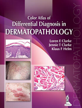 Clarke / Helm |  Color Atlas of Differential Diagnosis in Dermatopathology | Buch |  Sack Fachmedien