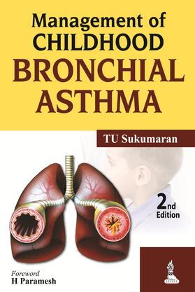 Sukumaran |  Management of Childhood Bronchial Asthma | Buch |  Sack Fachmedien