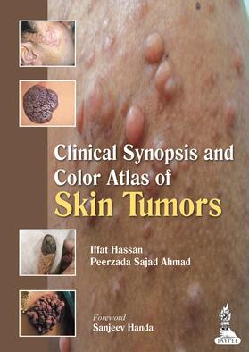 Hassan / Ahmad |  Clinical Synopsis and Color Atlas of Skin Tumors | Buch |  Sack Fachmedien