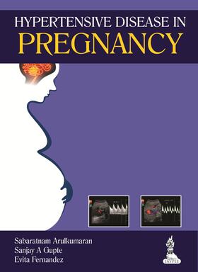 Arulkumaran / Gupte / Fernandez |  Hypertensive Disease in Pregnancy | Buch |  Sack Fachmedien