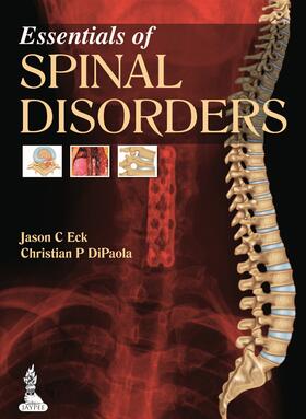 Eck / DiPaola |  Essentials of Spinal Disorders | Buch |  Sack Fachmedien