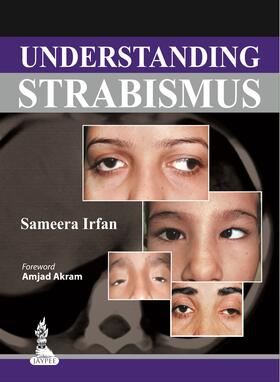 Irfan |  Understanding Strabismus | Buch |  Sack Fachmedien