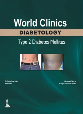 Mohan / Unnikrishnan |  World Clinics: Diabetology - Type 2 Diabetes Mellitus | Buch |  Sack Fachmedien