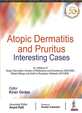 Godse |  Atopic Dermatitis and Pruritus | Buch |  Sack Fachmedien