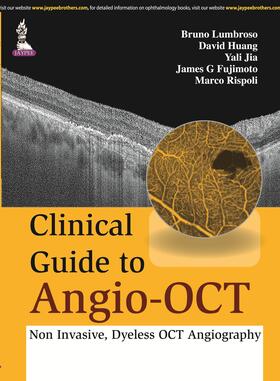 Lumbroso / Huang / Jia |  Clinical Guide to Angio-OCT: Non Invasive, Dyeless OCT Angiography | Buch |  Sack Fachmedien