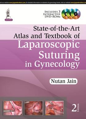 Jain |  State-of-the-Art Atlas and Textbook of Laparoscopic Suturing in Gynecology | Buch |  Sack Fachmedien