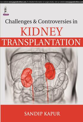 Kapur |  Challenges and Controversies in Kidney Transplantation | Buch |  Sack Fachmedien