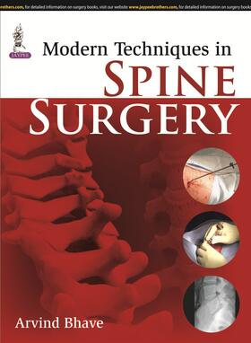 Bhave |  Modern Techniques in Spine Surgery | Buch |  Sack Fachmedien