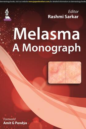 Sarkar |  Melasma: A Monograph | Buch |  Sack Fachmedien