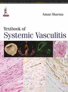 Sharma |  Textbook of Systemic Vasculitis | Buch |  Sack Fachmedien