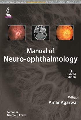 Agarwal |  Manual of Neuro-ophthalmology | Buch |  Sack Fachmedien