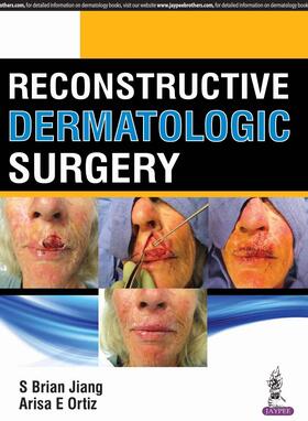 Jiang / Oritz / Ortiz |  Reconstructive Dermatologic Surgery | Buch |  Sack Fachmedien
