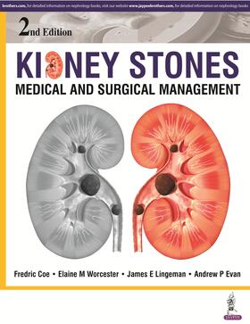 Coe / Worcester / Lingeman |  Kidney Stones | Buch |  Sack Fachmedien