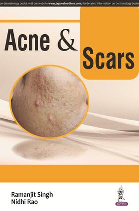 Singh / Rao |  ACNE and SCARS | Buch |  Sack Fachmedien