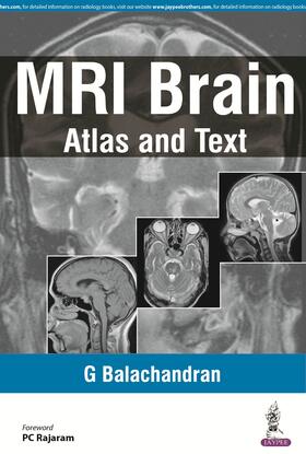 Balachandran |  MRI Brain | Buch |  Sack Fachmedien