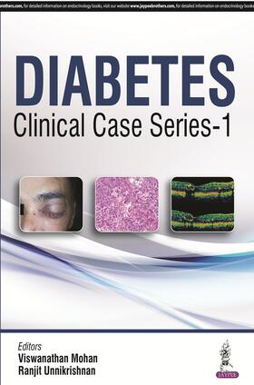 Mohan / Unnikrishnan |  Diabetes Clinical Case Series – 1 | Buch |  Sack Fachmedien