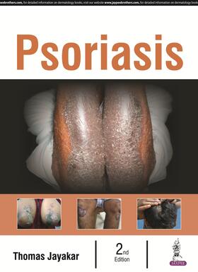 Thomas |  Textbook of Psoriasis | Buch |  Sack Fachmedien