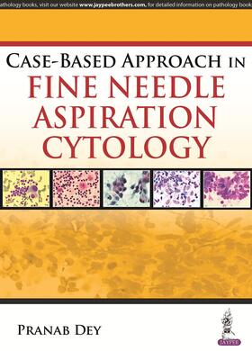 Dey |  Case-Based Approach in Fine Needle Aspiration Cytology | Buch |  Sack Fachmedien