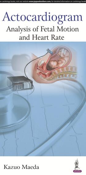 Maeda |  Actocardiogram | Buch |  Sack Fachmedien