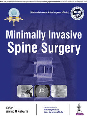 Kulkarni |  Minimally Invasive Spine Surgery | Buch |  Sack Fachmedien