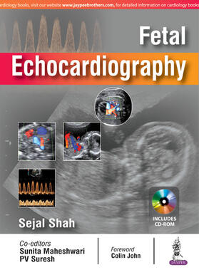 Shah / Maheshwari / Suresh |  Fetal Echocardiography | Buch |  Sack Fachmedien