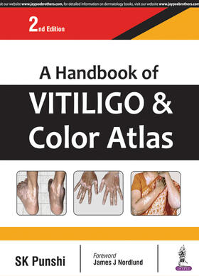 Punshi |  A Handbook of Vitiligo & Color Atlas | Buch |  Sack Fachmedien