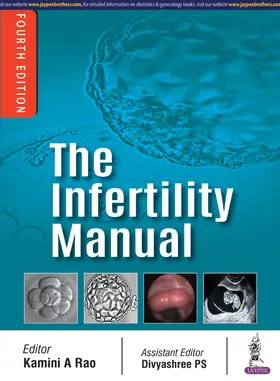 Rao |  Infertility Manual | Buch |  Sack Fachmedien