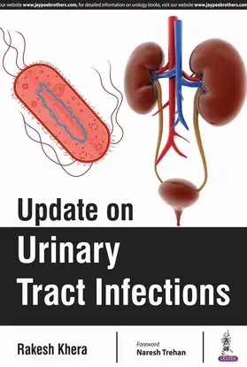 Khera |  Update on Urinary Tract Infections | Buch |  Sack Fachmedien