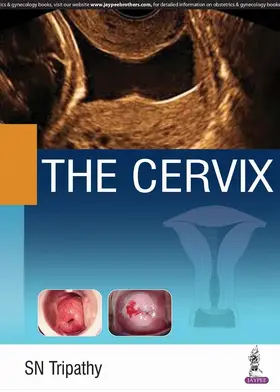 Tripathy |  The Cervix | Buch |  Sack Fachmedien