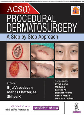 Vasudevan / Chatterjee / K |  Procedural Dermatosurgery | Buch |  Sack Fachmedien