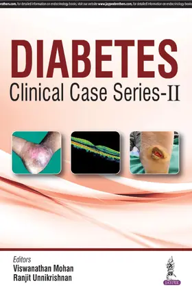 Mohan / Unnikrishnan |  Diabetes Clinical Case Series - 2 | Buch |  Sack Fachmedien