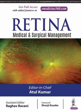 Kumar |  RETINA | Buch |  Sack Fachmedien