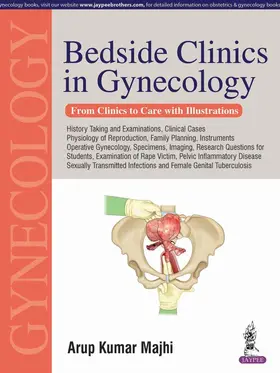 Majhi |  Bedside Clinics in Gynecology | Buch |  Sack Fachmedien