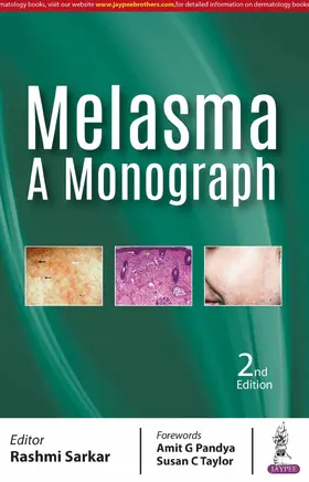 Sarkar |  Melasma: A Monograph | Buch |  Sack Fachmedien