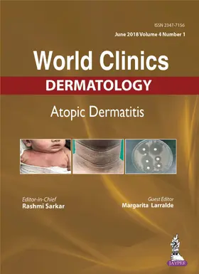 Sarkar / Larralde |  WORLD CLINICS-ATOPIC DERMATITIS (JUNE 2018, VOL.04 ISSUE 1) | Buch |  Sack Fachmedien