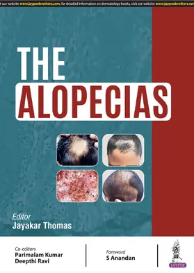 Thomas |  THE ALOPECIAS | Buch |  Sack Fachmedien