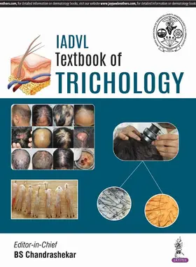 Chandrashekar |  IADVL Textbook of Trichology | Buch |  Sack Fachmedien