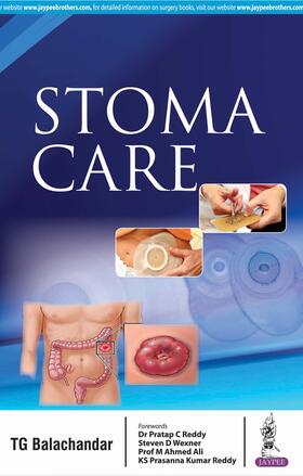 Balachandar |  Stoma Care | Buch |  Sack Fachmedien