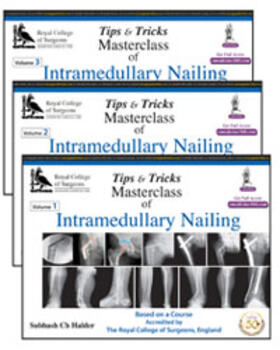 Halder |  Tips and Tricks: Masterclass of Intramedullary Nailing | Buch |  Sack Fachmedien