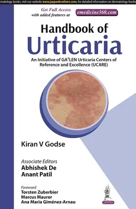 Godse / De / Patil |  Handbook of Urticaria | Buch |  Sack Fachmedien