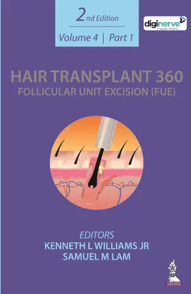 Lam / Williams Jr |  Hair Transplant 360: Follicular Unit Excision (FUE) | Buch |  Sack Fachmedien